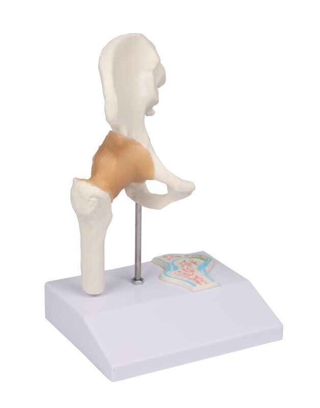 Miniatyr höftled med tvärsnitt