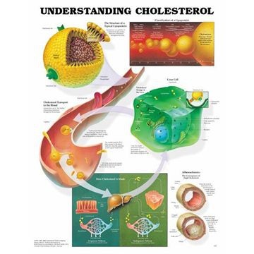 Undervisningsplansch Kolesterol och lipoproteiner, laminerad 51x66 cm
