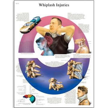 Whiplashskada 50x67 cm