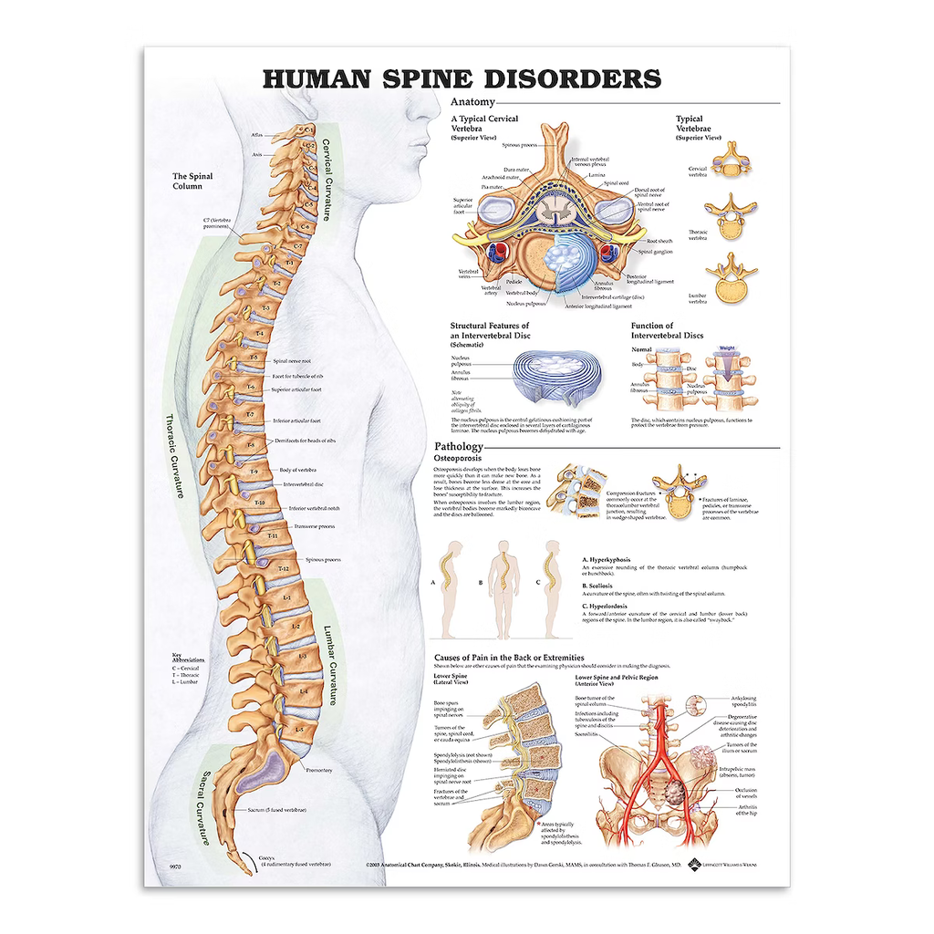Sjukdom i ryggraden affisch med baksida i PET-plastfilm samt matt framsida engelsk version (Human spine disorders)