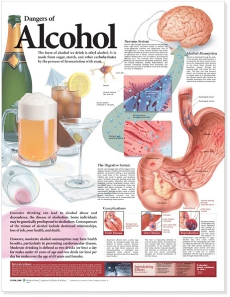Laminerad affisch på alkoholens skadliga effekter på engelska
