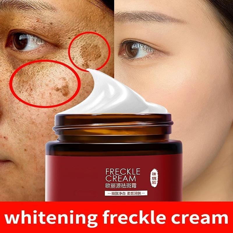 Vitgörande Fräckkräm Ta bort Melasma Fläck Akne Pigment Melanin Mörka Fläckar Pigmentering Fräckborttagningskräm 15G brown